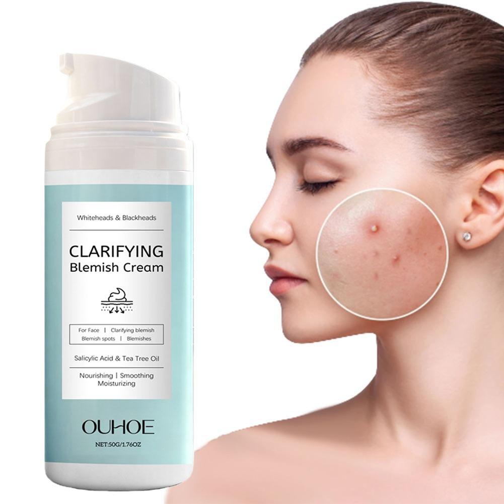 Salicylic Acid Blackhead Remover - Krim Penghilang Jerawat Asam Salisilat Krim