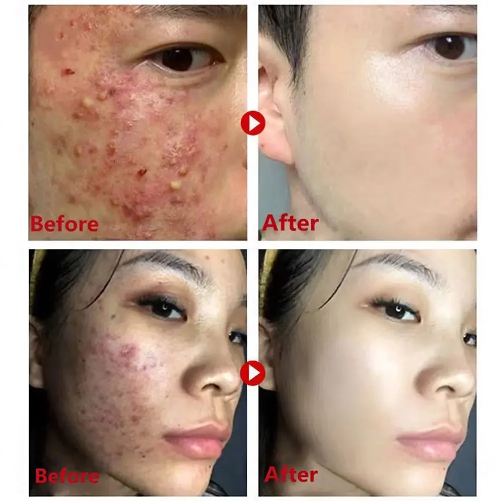 Masker Perawatan Kulit teh hij - Green Tea Cleansing Clay Mask ulasan dan harga