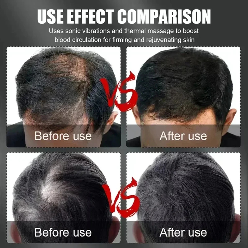 Topi Terapi Rambut Cahaya Mera - Hair Care ulasan dan harga
